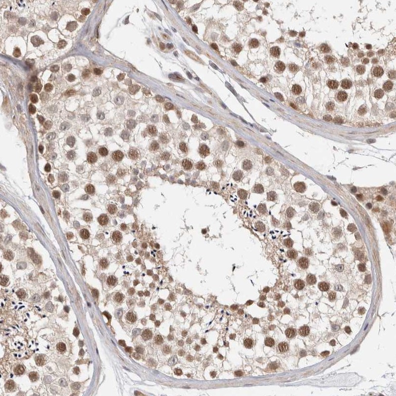 Anti-ZNF318 Antibody