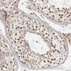 Anti-ZNF318 Antibody