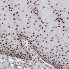 Anti-EYA2 Antibody