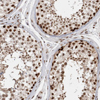 Anti-EYA2 Antibody