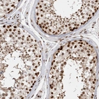 Immunohistochemical staining of human testis shows moderate to strong nuclear positivity in cells in seminiferous ducts.