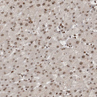 Immunohistochemical staining of human liver shows weak to moderate nuclear positivity in hepatocytes.