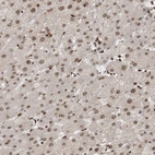 Immunohistochemical staining of human liver shows weak to moderate nuclear positivity in hepatocytes.
