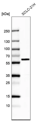 Western blot analysis in human cell line SCLC-21H.