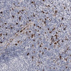 Anti-CYB561D1 Antibody