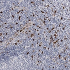 Anti-CYB561D1 Antibody