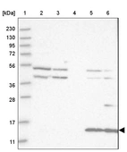 Lane 1: Marker [kDa] 230, 130, 95, 72, 56, 36, 28, 17, 11_br/_Lane 2: Human cell line RT-4_br/_Lane 3: Human cell line U-251MG sp_br/_Lane 4: Human plasma (IgG/HSA depleted)_br/_Lane 5: Human liver tissue_br/_Lane 6: Human tonsil tissue
