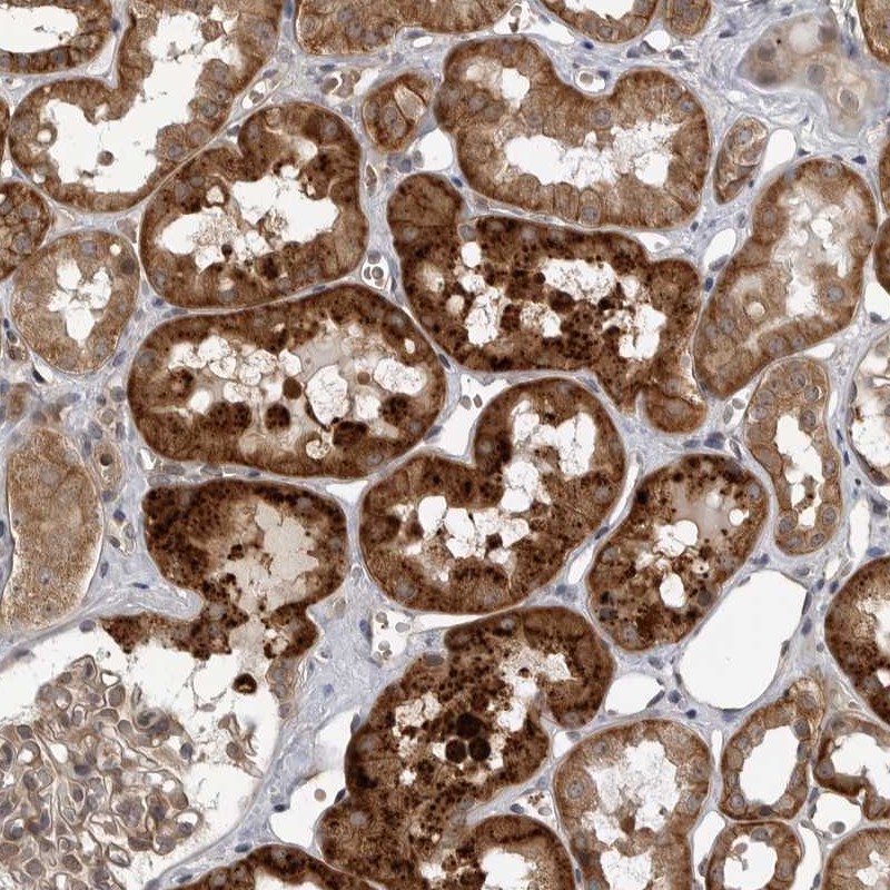 Anti-WNT16 Antibody