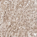 Anti-ZNF318 Antibody