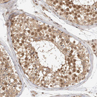Immunohistochemical staining of human testis shows strong nuclear and cytoplasmic positivity in cells in seminiferous ducts.