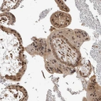 Immunohistochemical staining of human placenta shows moderate nuclear and cytoplasmic positivity in trophoblastic cells.