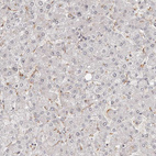 Immunohistochemical staining of human liver shows no positivity in hepatocytes as expected.