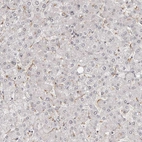 Immunohistochemical staining of human liver shows no positivity in hepatocytes as expected.