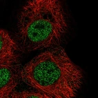 Immunofluorescent staining of human cell line A-431 shows localization to nucleoplasm.