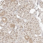 Anti-ASCL3 Antibody