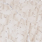 Immunohistochemical staining of human skeletal muscle shows moderate nuclear positivity in myocytes.
