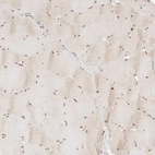 Immunohistochemical staining of human skeletal muscle shows moderate nuclear positivity in myocytes.