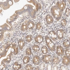 Immunohistochemical staining of human duodenum shows moderate cytoplasmic positivity in glandular cells.