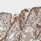 Anti-ASTN2 Antibody
