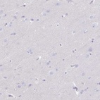 Immunohistochemical staining of human cerebral cortex shows low expression as expected.