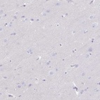 Anti-GPR182 Antibody