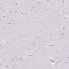 Immunohistochemical staining of human cerebral cortex shows low expression as expected.