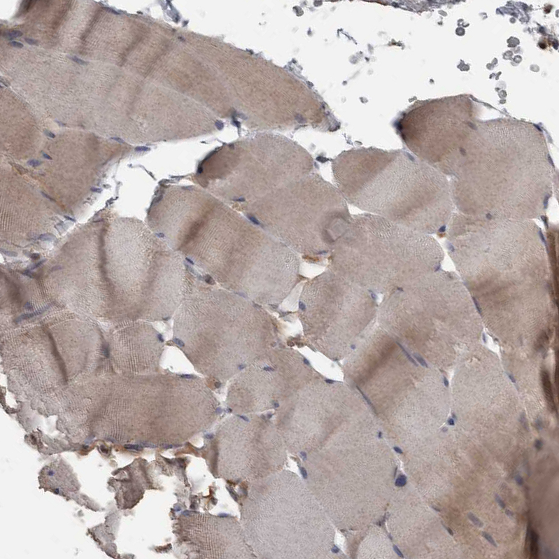 Anti-PPP1R3C Antibody