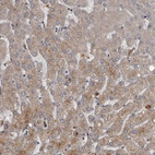 Immunohistochemical staining of human liver shows moderate cytoplasmic positivity in hepatocytes.