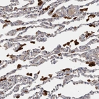 Immunohistochemical staining of human lung shows strong cytoplasmic positivity in macrophages.