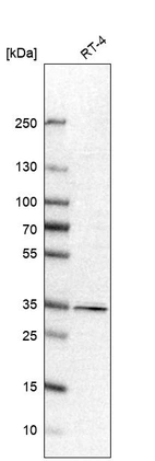 Western blot analysis in human cell line RT-4.