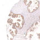 Immunohistochemical staining of human prostate shows strong cytoplasmic/ membranous positivity in glandular cells.