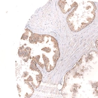 Immunohistochemical staining of human prostate shows strong cytoplasmic/ membranous positivity in glandular cells.