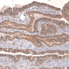 Immunohistochemical staining of human fallopian tube shows strong membranous positivity in glandular cells.