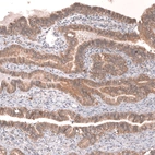 Immunohistochemical staining of human fallopian tube shows strong membranous positivity in glandular cells.