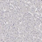 Immunohistochemical staining of human liver shows no cytoplasmic positivity in hepatocytes as expected.
