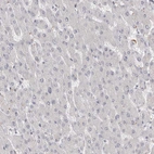 Immunohistochemical staining of human liver shows no cytoplasmic positivity in hepatocytes as expected.