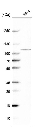 Western blot analysis in human cell line SiHa.