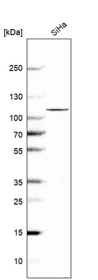 Western blot analysis in human cell line SiHa.