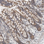 Anti-TMEM199 Antibody