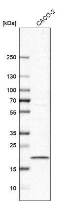 Western blot analysis in human cell line CACO-2.