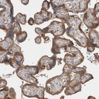 Anti-GPER1 Antibody