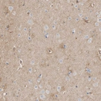 Immunohistochemical staining of human cerebral cortex shows weak positivity in neuropil.