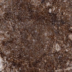 Immunohistochemical staining of human lymphoid tissues shows strong cytoplasmic positivity in lymphocytes.