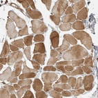 Immunohistochemical staining of human skeletal muscle shows moderate cytoplasmic positivity in myocytes.