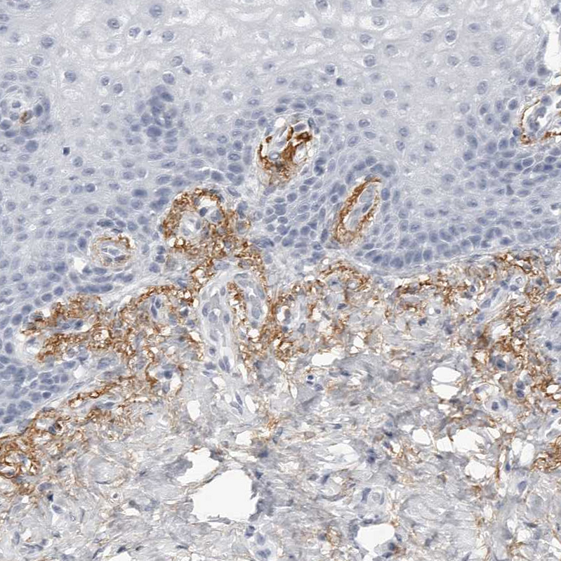 Anti-COL26A1 Antibody