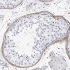 Immunohistochemical staining of human testis shows strong membranous positivity in peritubular myoid cells.