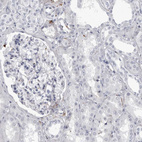 Immunohistochemical staining of human kidney shows no positivity in cells in tubules as expected.