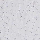 Immunohistochemical staining of human skeletal muscle shows no positivity in myocytes as expected.