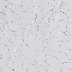 Immunohistochemical staining of human skeletal muscle shows no positivity in myocytes as expected.