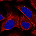 Immunofluorescent staining of human cell line U-2 OS shows localization to vesicles.
